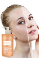 Pierre Cardin Sebum Control Sivilce Karşıtı %2 SALİSİLİK ASİT Yağsız Günlük Yüz Temizleme Jeli 350 ml